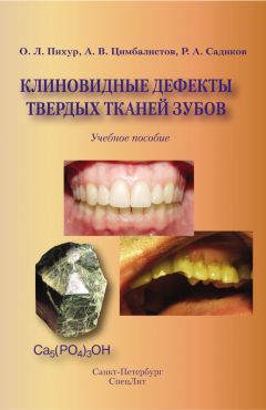 Оксана Пихур - Клиновидные дефекты твердых тканей зубов