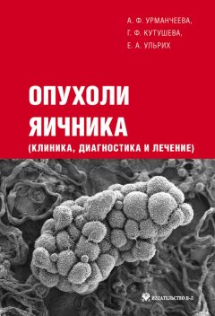 Елена Ульрих - Опухоли яичника: клиника, диагностика и лечение
