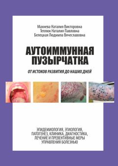 Людмила Белецкая - Аутоиммунная пузырчатка. От истоков развития до наших дней