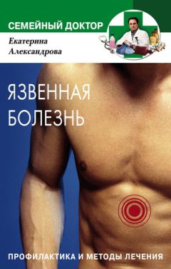 Екатерина Александрова - Язвенная болезнь. Профилактика и методы лечения