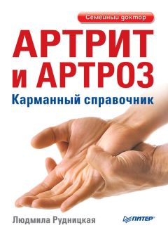 Людмила Рудницкая - Артрит и артроз. Карманный справочник